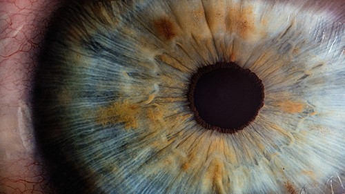 Eye